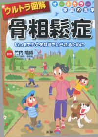 ウルトラ図解 骨粗鬆症 いつまでも丈夫な骨でいられるために オールカラー家庭の医学