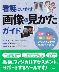 看護にいかす画像の見かたガイド X線・CT・MRI・エコーでアセスメントの精度が上がる